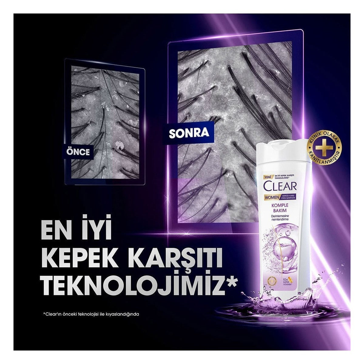350 ml X3 Women Shampoo - Complete Care Effective Against Dandruff